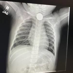 Meet your Posher, Alan